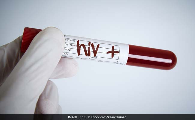 20-people-are-found-hiv-positive-at-unnao-uttar-pradesh